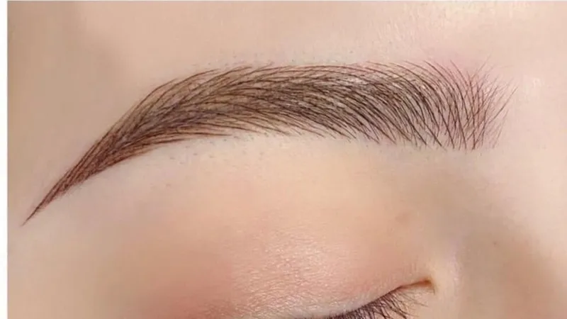 Chân mày trong giai đoạn bong vảy sau khi điêu khắc thẩm mỹ